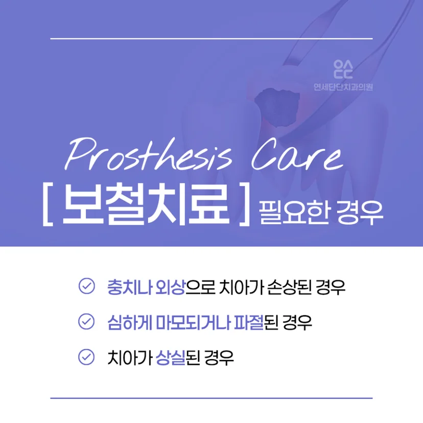 보철치료 필요한 경우