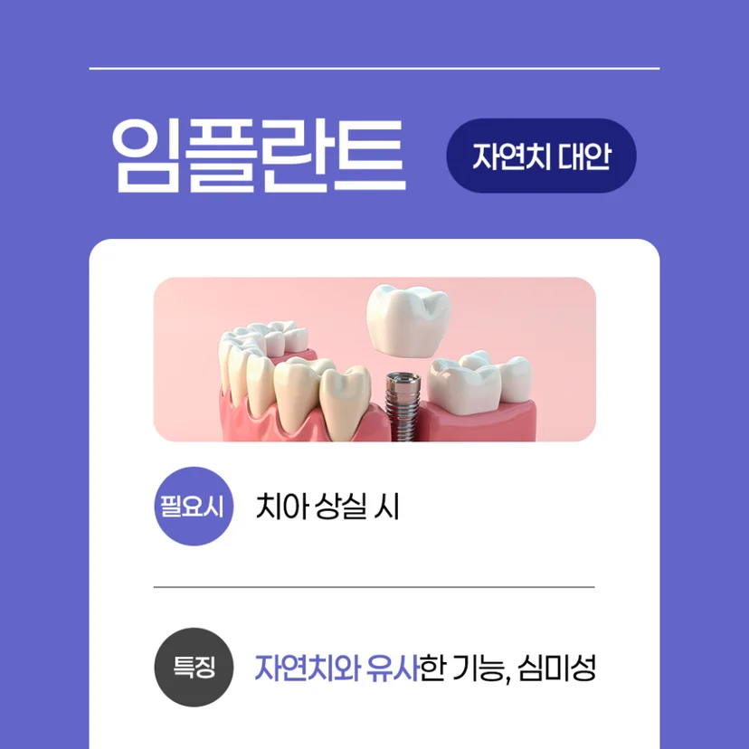 임플란트 보철치료