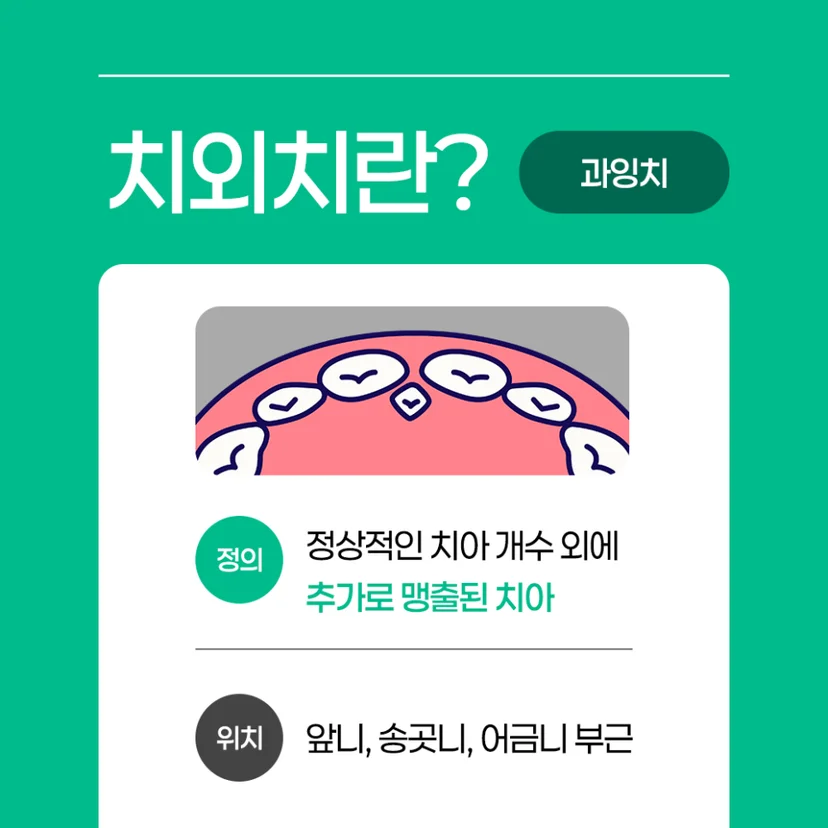 치외치 설명