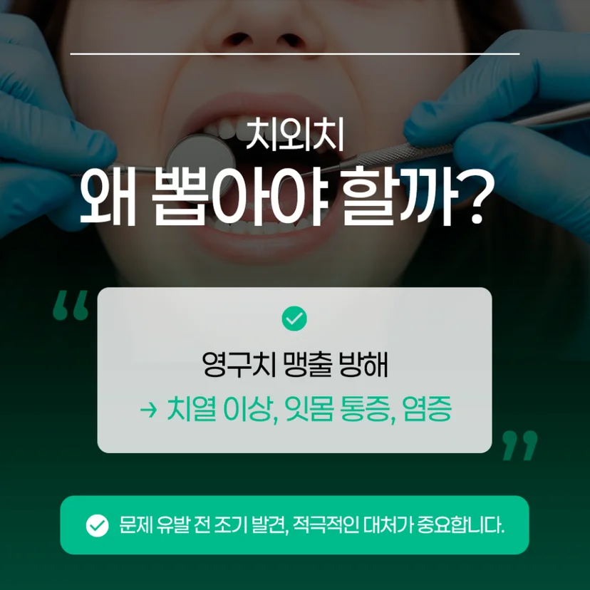 치외치 발치 이유
