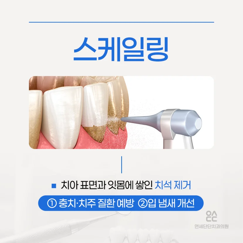 스케일링 설명