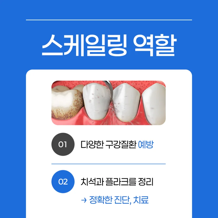 스케일링 역할