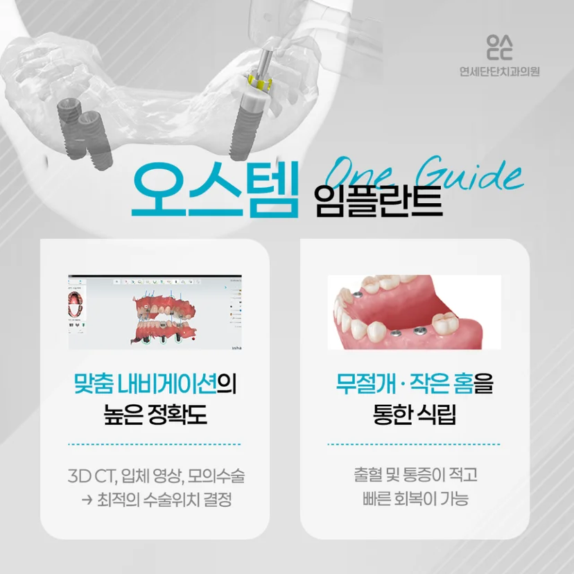 오스템 디지털 임플란트