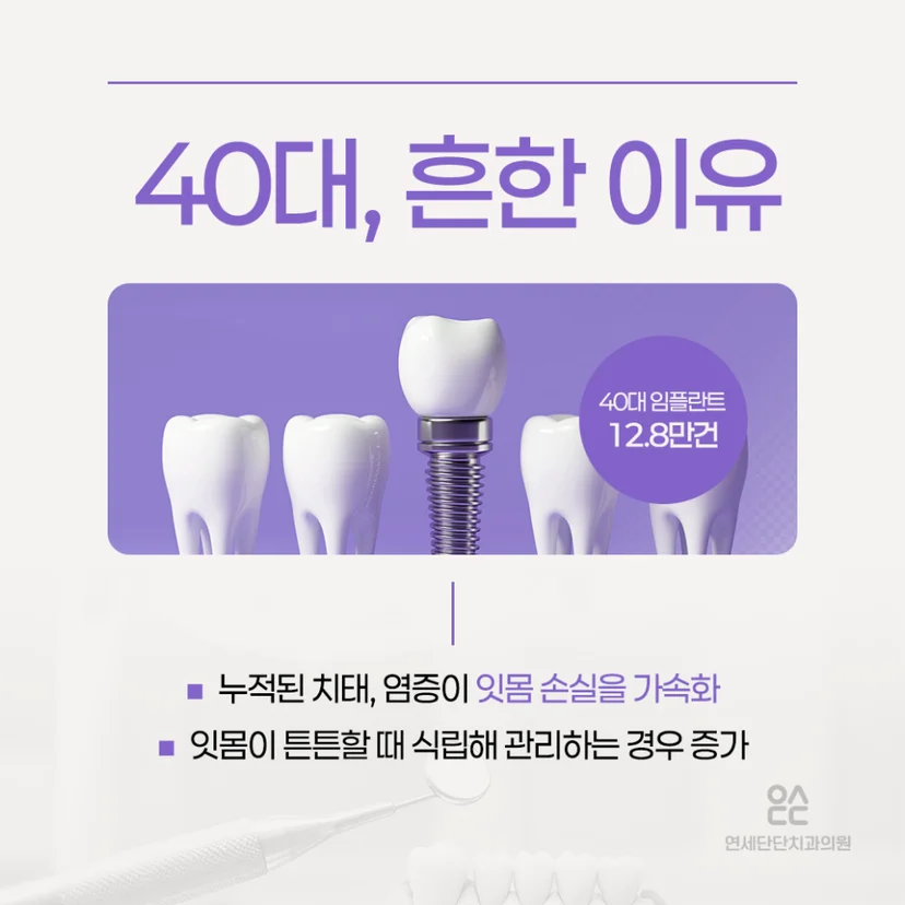 40대 임플란트가 흔한 이유
