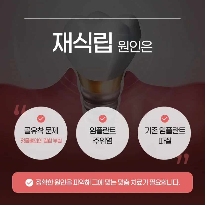 임플란트 재식립 원인