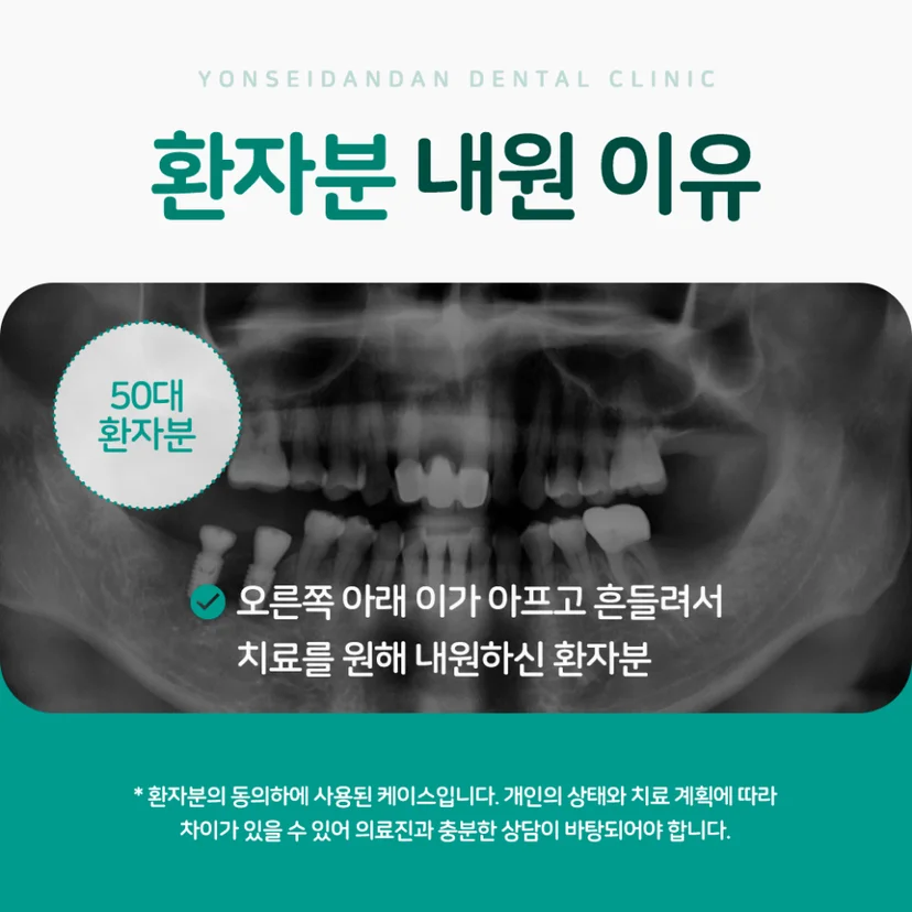 50대 환자 증례