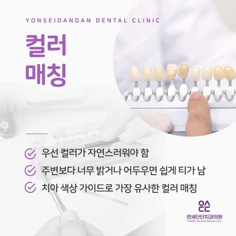 앞니임플란트 컬러 매칭
