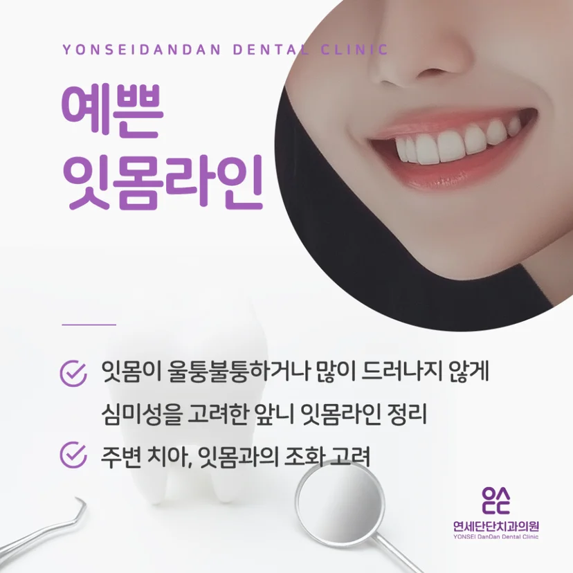 예쁜 잇몸라인 정리