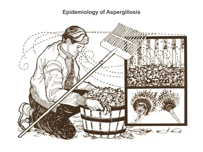 아스페르길루스증(Aspergillosis) 역학 일러스트 – 유기물과 토양에서 공기 중으로 퍼지는 곰팡이 포자가 전파되는 경로를 표현한 이미지