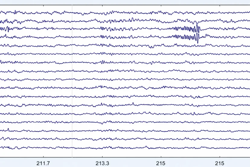 ADHD 판별 AI 학습을 위한 뇌파(EEG) Raw 데이터 시각화 샘플 이미지