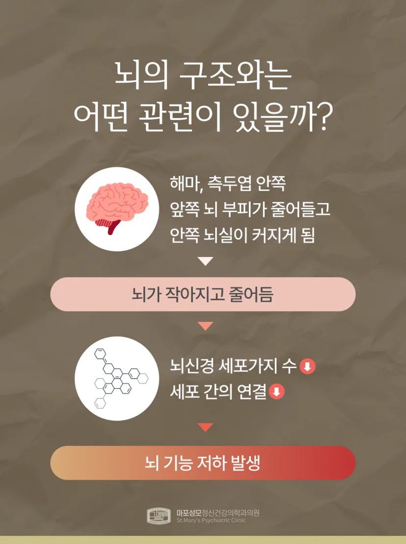 치매와 뇌 구조