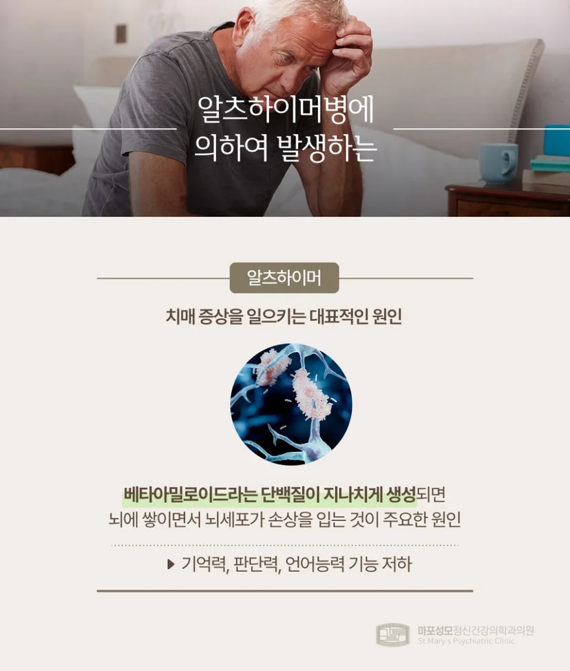 치매 알츠하이머 설명