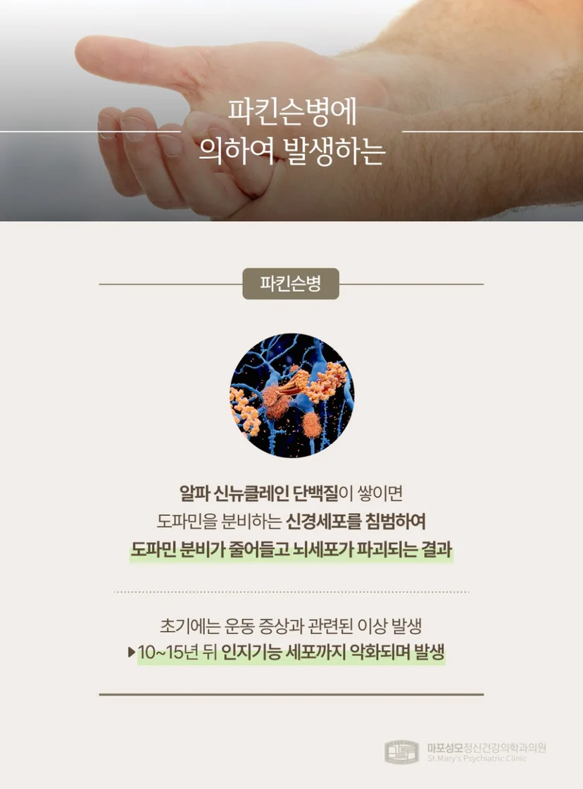치매 파킨슨병 설명