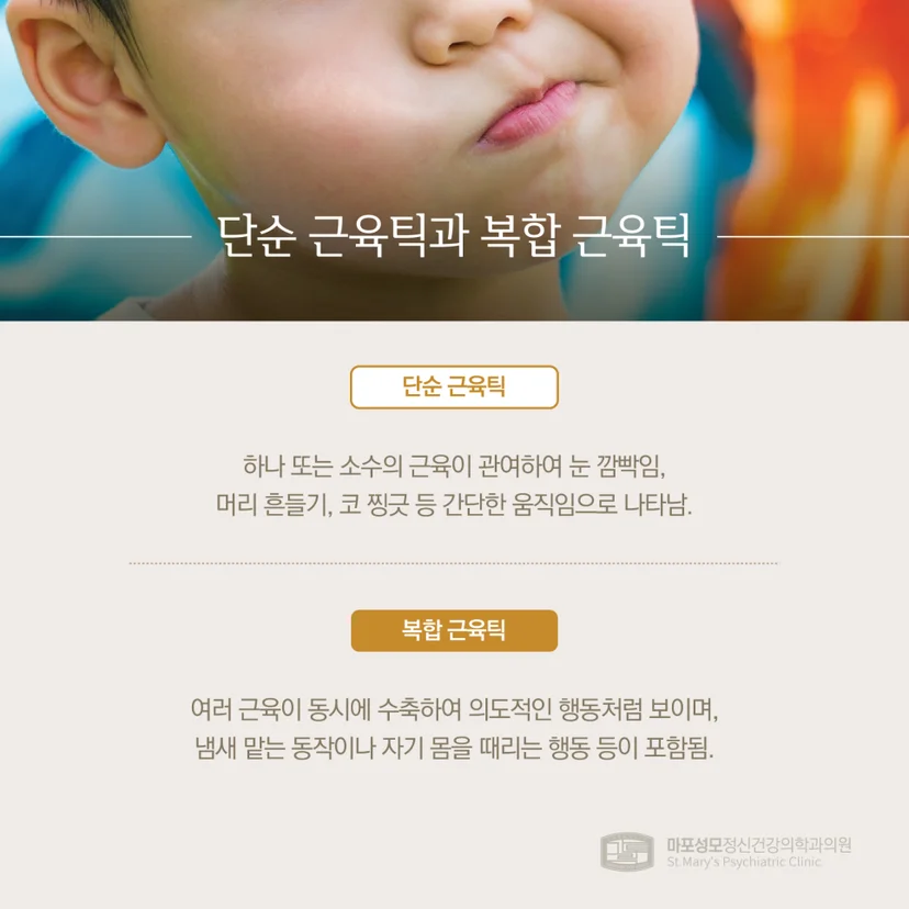 단순 근육틱과 복합 근육틱