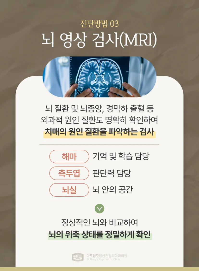 치매 진단 MRI