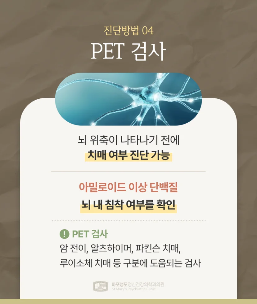 치매 진단 PET 검사