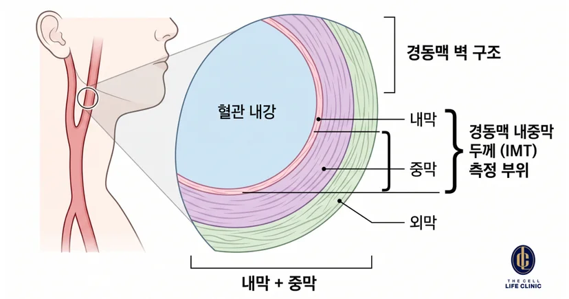 혈관 벽 내막,중막,외막 단면을 확대해 두께를 표시한 이미지