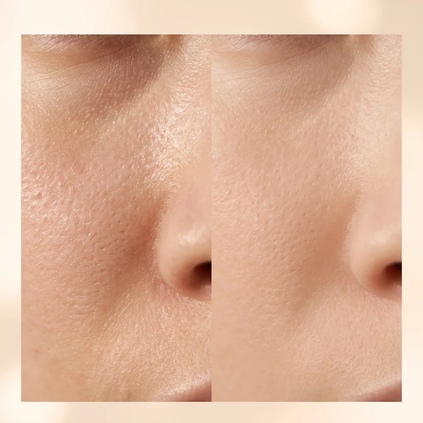 Side-by-side macro close-up of skin around the nose area — left side showing visibly enlarged, textured pores with uneven surface, right side showing significantly refined, smoother pores with more even skin texture. AI-generated visual simulation for illustrative purposes only; not an actual person or real product-use result.