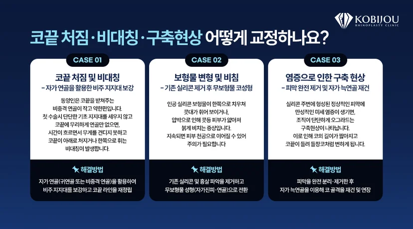 [코비쥬의원] 코끝 처짐, 보형물 변형, 구축코의 원인과 교정 방법을 비교한 이미지