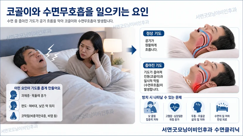 코골이와 수면무호흡을 유발하는 요인