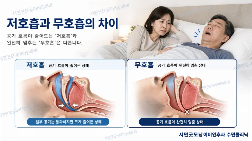 저호흡과 무호흡 상태