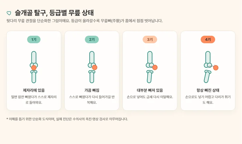 슬개골 탈구 등급 1~4기 다리 모양 비교 도식