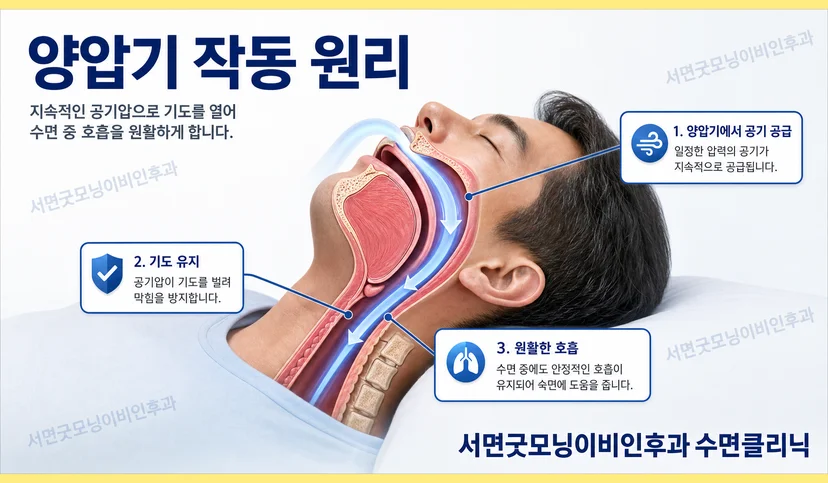 수면무호흡증 양압기 치료