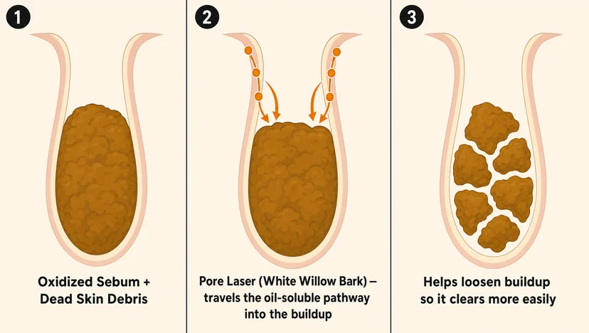 Three-panel pore cross-section diagram showing how Pore Laser™ works — panel 1 shows a pore filled with oxidized sebum and dead skin debris, panel 2 shows Pore Laser™ white willow bark traveling the oil-soluble pathway down into the buildup, panel 3 shows the buildup broken into smaller separated pieces, labeled "helps loosen buildup so it clears more easily"