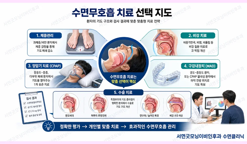 부산수면무호흡증 치료 방법
