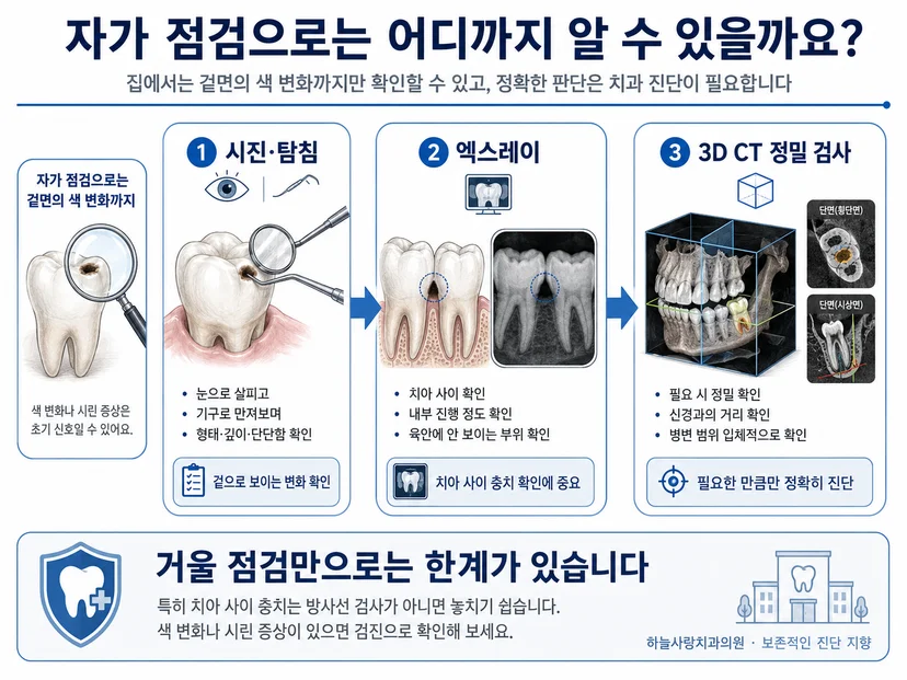 충치 진단 과정 시진 탐침 엑스레이 3D CT 검사