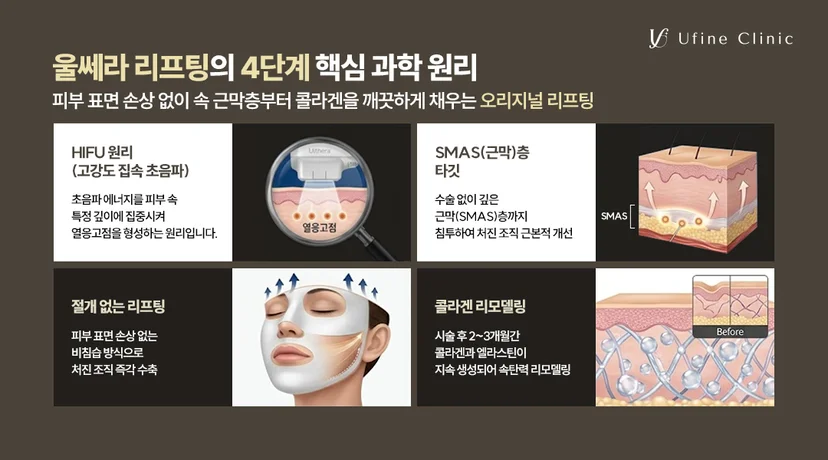 불당동피부과 유파인의원 울쎄라피 프라임 리프팅 근막층 타깃 및 콜라겐 생성 4단계 과학 원리 안내