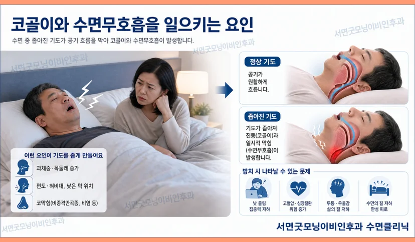 코골이, 수면무호흡증을 유발하는 요인
