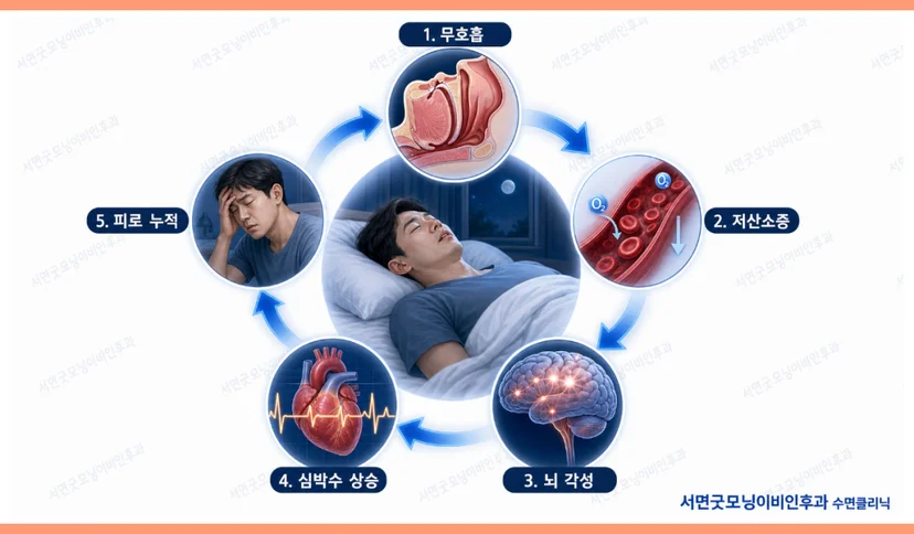 수면무호흡증으로 인해 수면 문제가 발생하는 과정