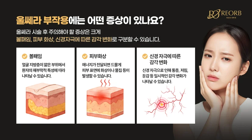 리오브피부과 울쎄라리프팅 