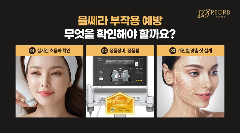 리오브피부과 울쎄라리프팅 시술 전 확인 사항