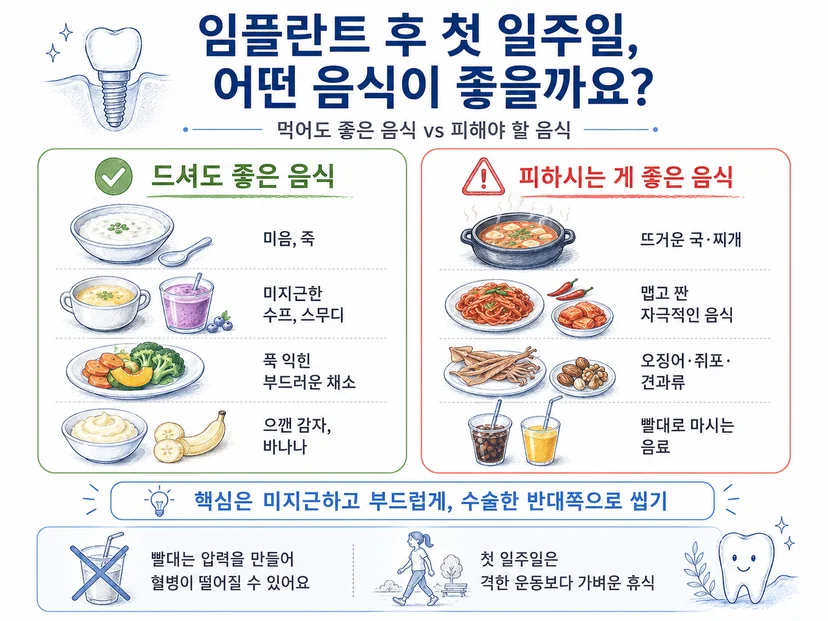 임플란트 후 먹어도 되는 음식과 피해야 할 음식 비교 이미지