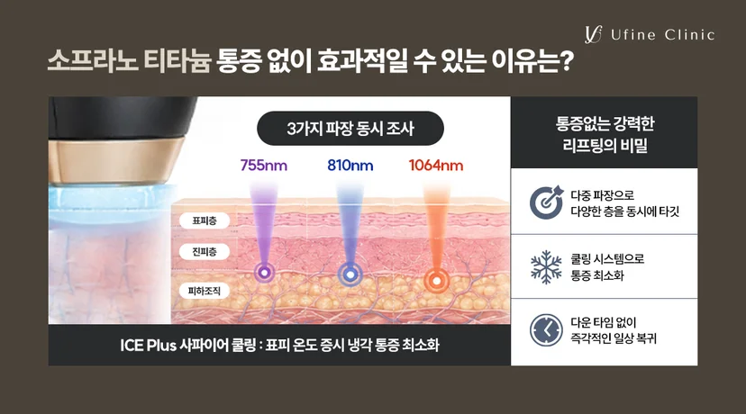 천안티타늄 소프라노 티타늄 리프팅 3가지 파장 동시 조사 및 쿨링 시스템 원리