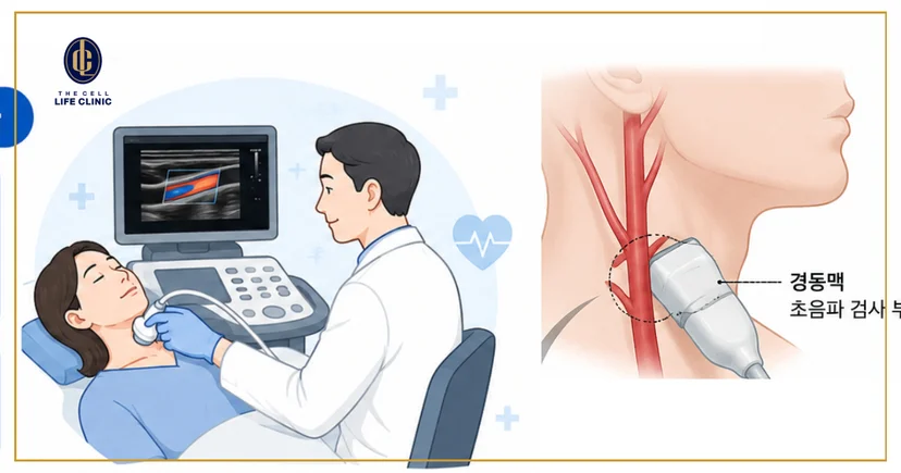 목 부위 초음파 검사를 받는 환자 모습 또는 경동맥 혈류 일러스트