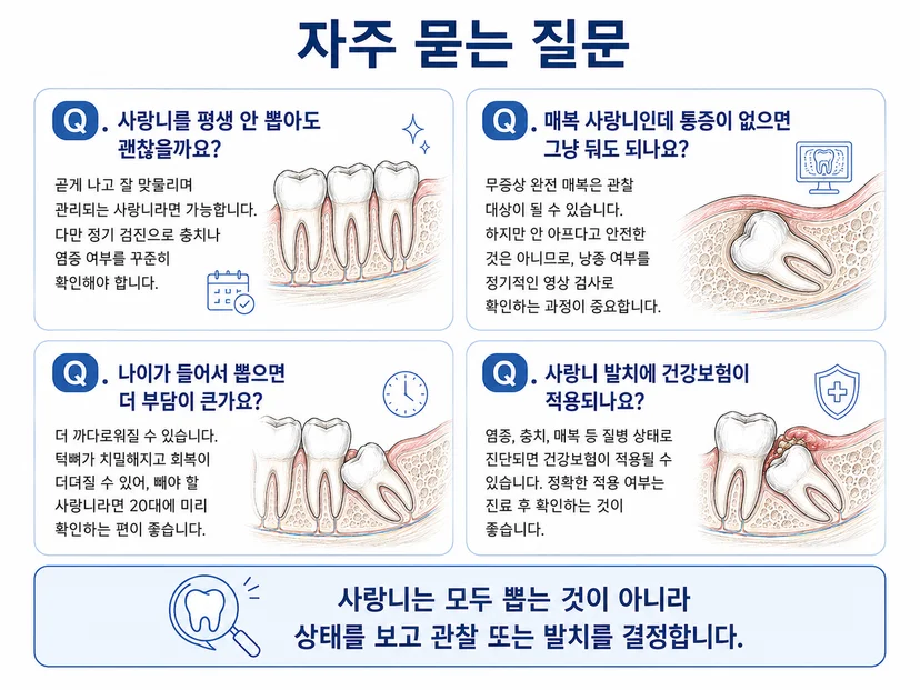 사랑니를 뽑지 않을 경우에 대해 자주 묻는 네 가지 질문과 답변을 정리한 카드