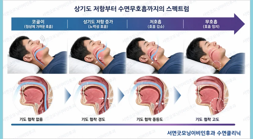 상기도 저항부터 수면무호흡증까지 스펙트럼