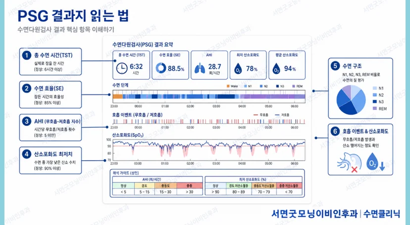 수면다원검사 결과지 읽는 방법