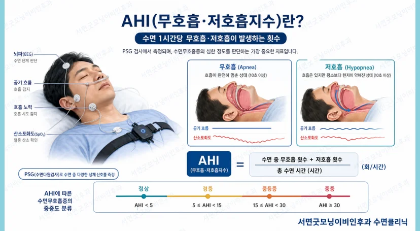 수면 검사 시 확인할 수 있는 AH지수