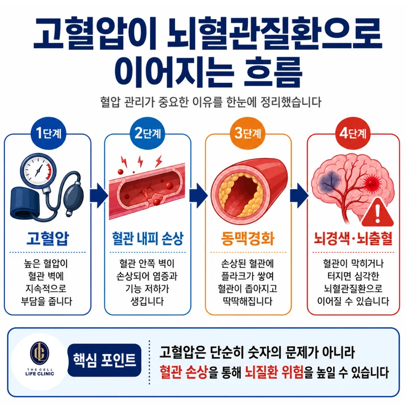 고혈압 → 혈관 내피 손상 → 동맥경화 → 뇌경색·뇌출혈 흐름도