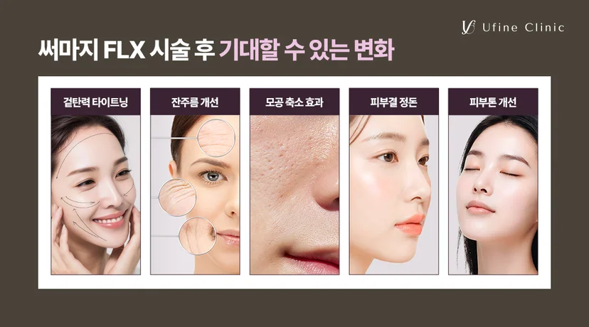 천안써마지 써마지FLX 시술 후 기대할 수 있는 변화