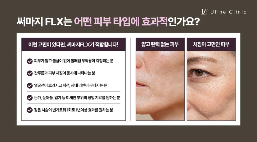 천안써마지 볼패임 걱정 없는 얇은 피부 잔주름 해결 써마지FLX 추천 대상