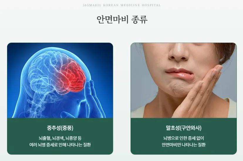 안면마비 초기 단계|중추성과 말초성 안면마비 종류 비교 설명