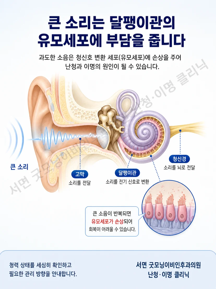 큰 소리가 달팽이관의 청각 감각세포에 부담을 주는 원리