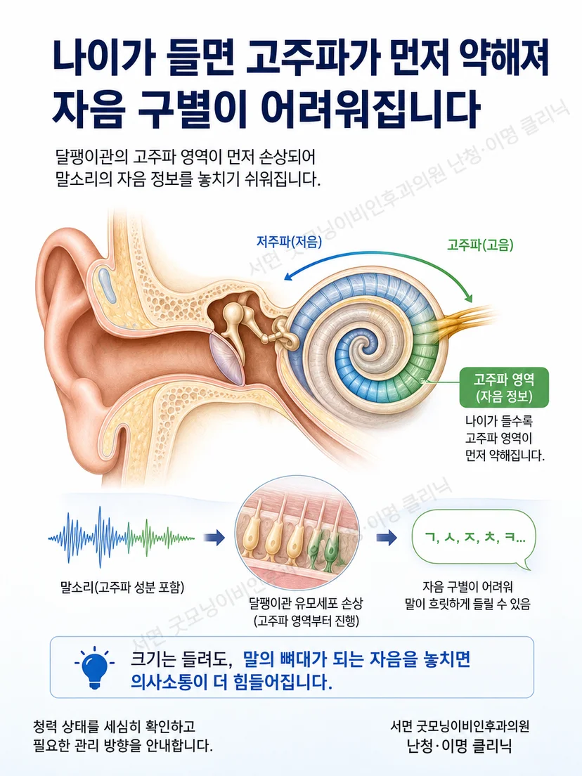 달팽이관의 고주파 영역과 자음 정보 저하를 나타낸 개념도