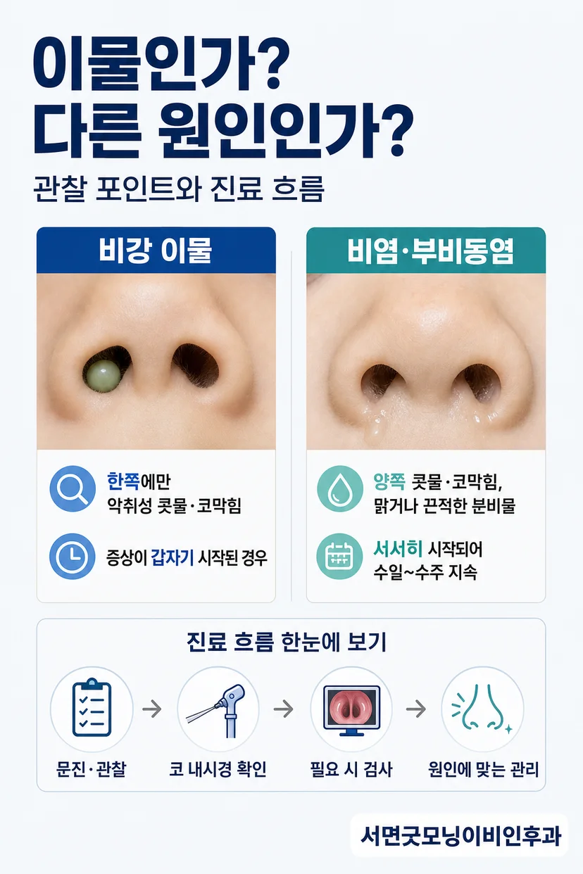 의료진이 비강 이물을 제거하는 모습