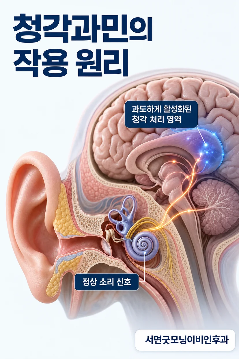 청각과민으로 인한 불편감